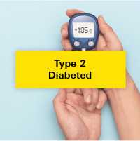 Type 2 Diabeted